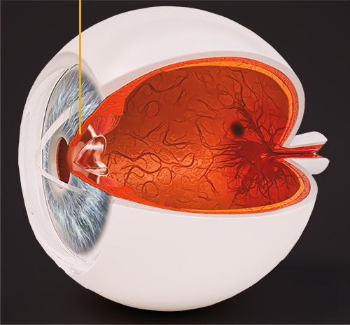 Zeigt den Querschnitt eines Auges sowie die Position der Iris